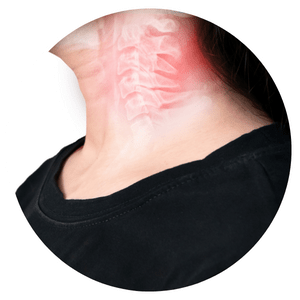 Spondylosis Treatment