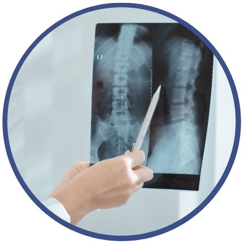 Thompson Chiropractic Technique xray image