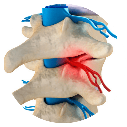 chiropractor for sciatica